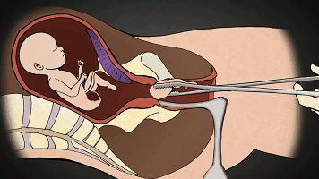 被孩子撞见你们在干嘛怎么回答,被孩子撞见了你该如何去解释