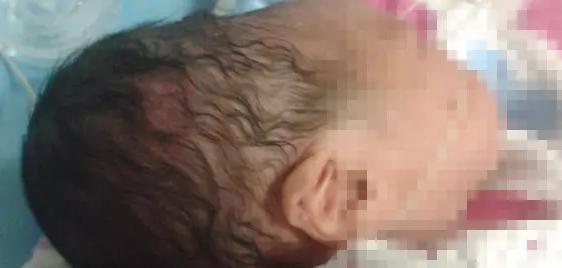 刚出生的宝宝特殊现象,刚出生宝宝吓住了怎么办