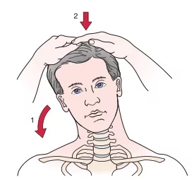 肩胛背神经卡压与颈椎病的区别,肩颈神经压迫会脖子痛吗