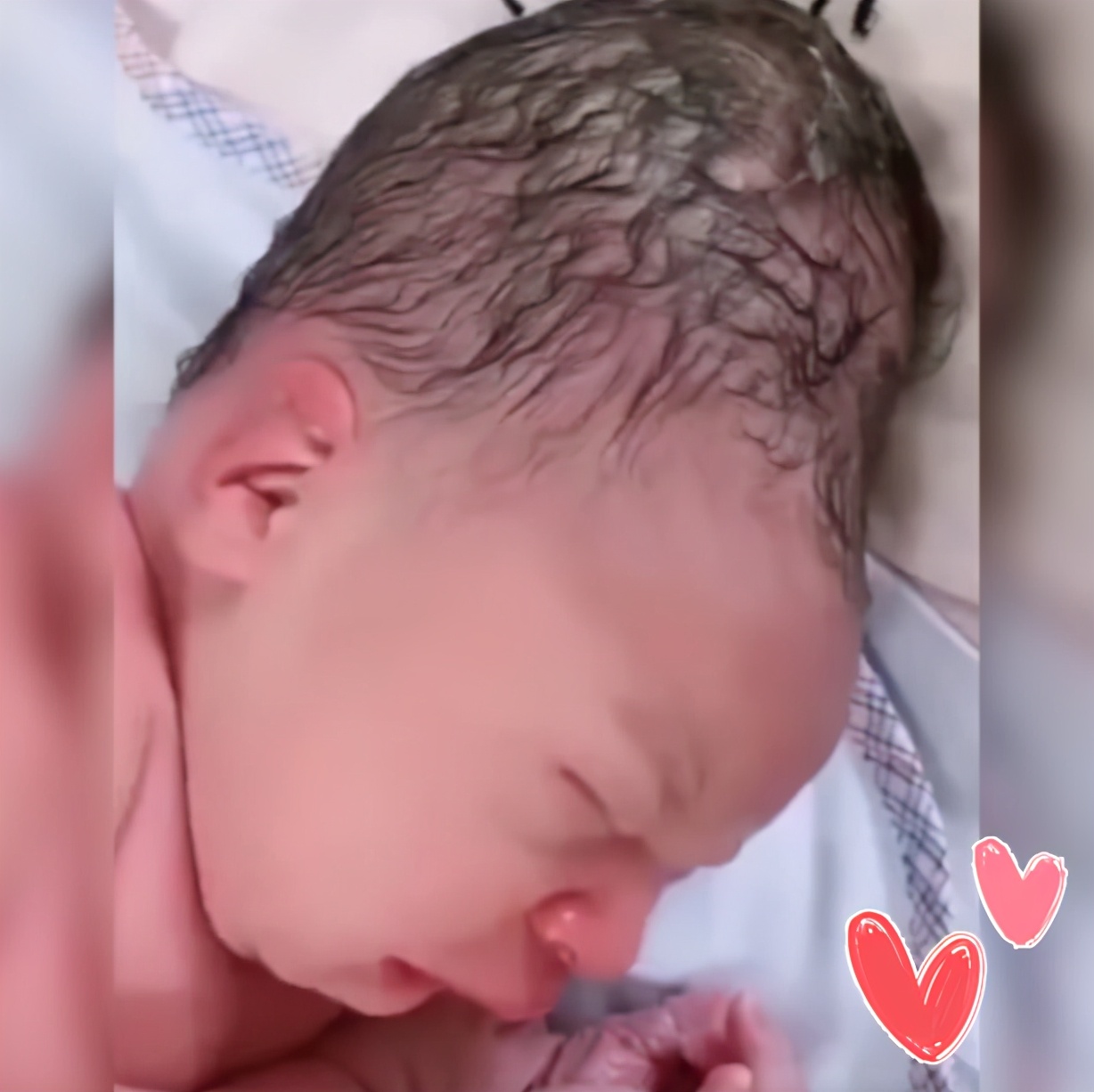 婴儿睡出尖脑瓜怎么办,新生儿脑壳尖