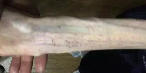 高三女生3个月只吃黄瓜！出大事了！妈妈哭死：怎么劝都不听