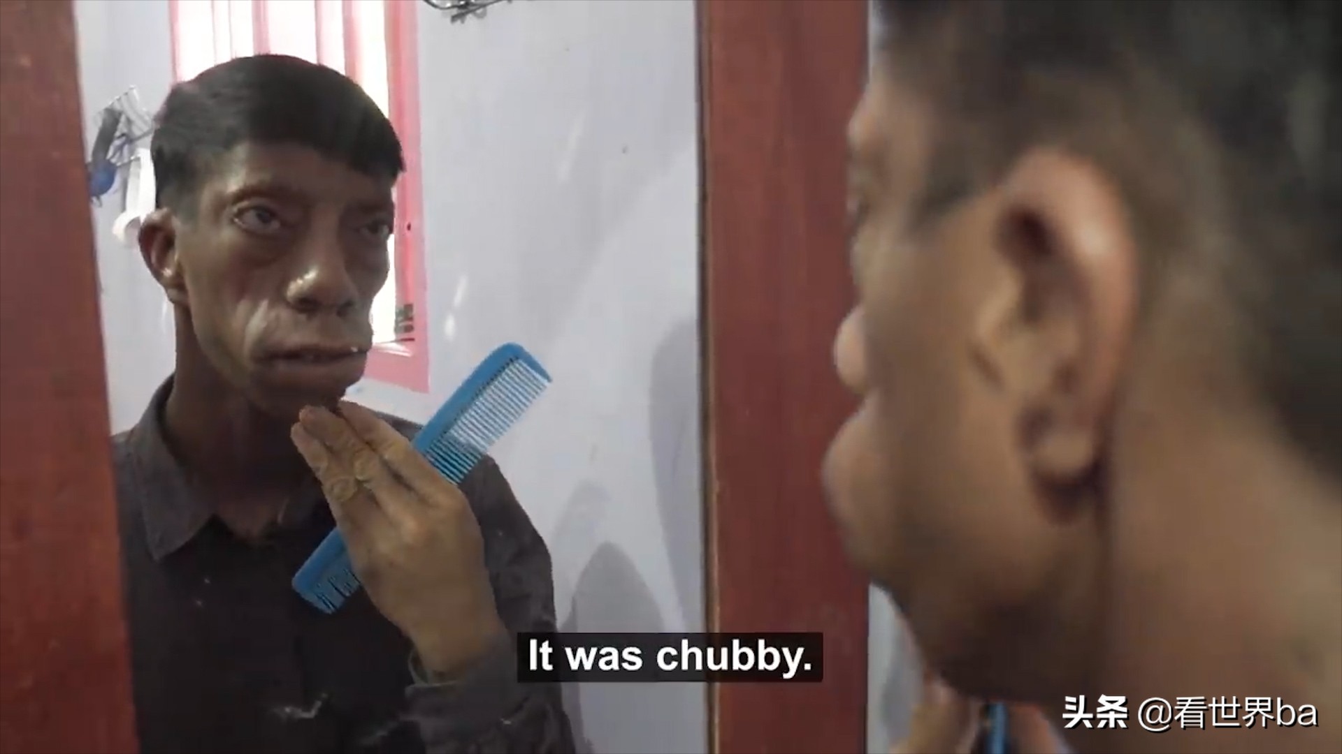 印尼家族怪脸,印尼怪病