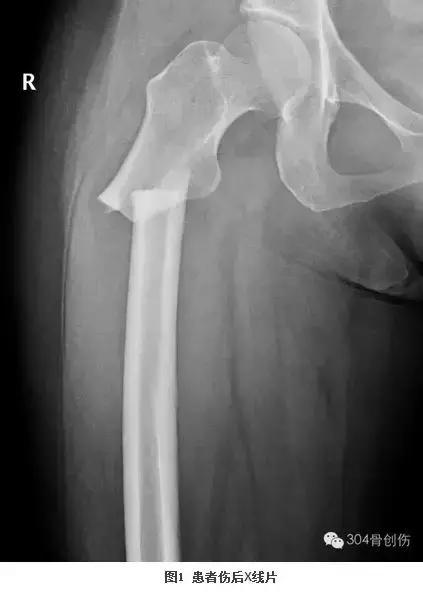 循证医学学习指导,循证医学连续病例