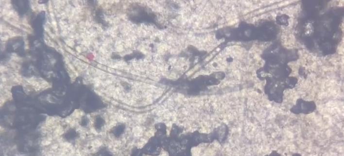 显微镜看肚脐眼里的泥,用显微镜放大肚脐眼里面的泥