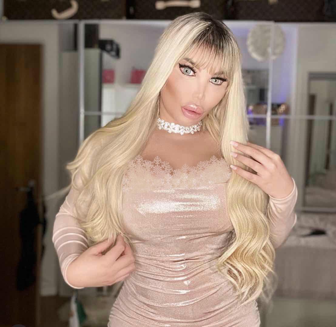 巴西男整容42次图片,巴西男模花数百万整容