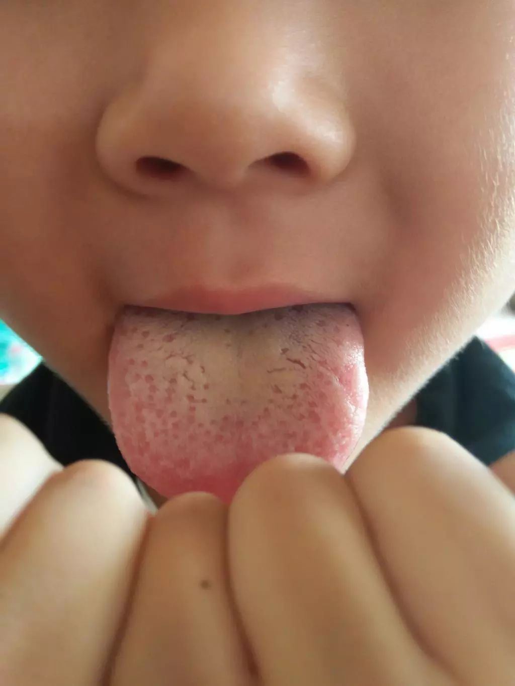 反复咳嗽怎么能根除,小猪反复咳嗽怎么治