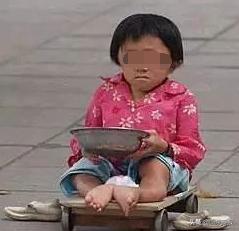 眼球被挖的人后续,眼球被挖了还能医吗