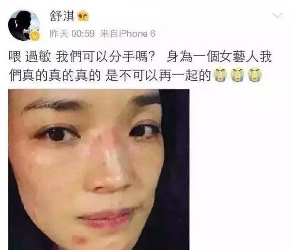 敏感肌30秒自测,敏感肌全套护肤推荐