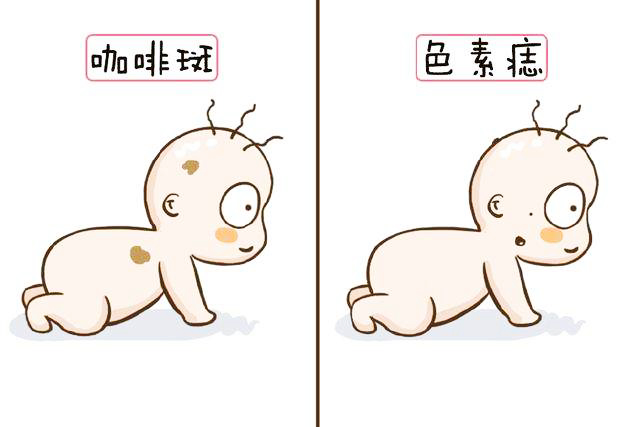 中心型鲜红斑痣治疗最佳办法,中心医院祛斑祛痣