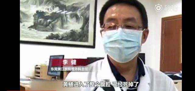 男子将黄鳝塞体内治便秘,男子塞黄鳝治便秘险丧命