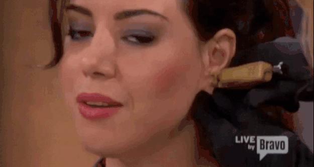 打耳洞为什么会长瘢痕疙瘩,打耳洞导致长了小肉球