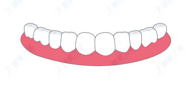 蛀牙牙龈出血怎么办,牙齿出血是不是蛀牙了怎么才能好