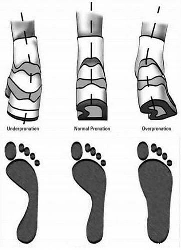 小腿肌肉外翻骨头是弯的,小腿外翻有明显的肌肉腿怎么办