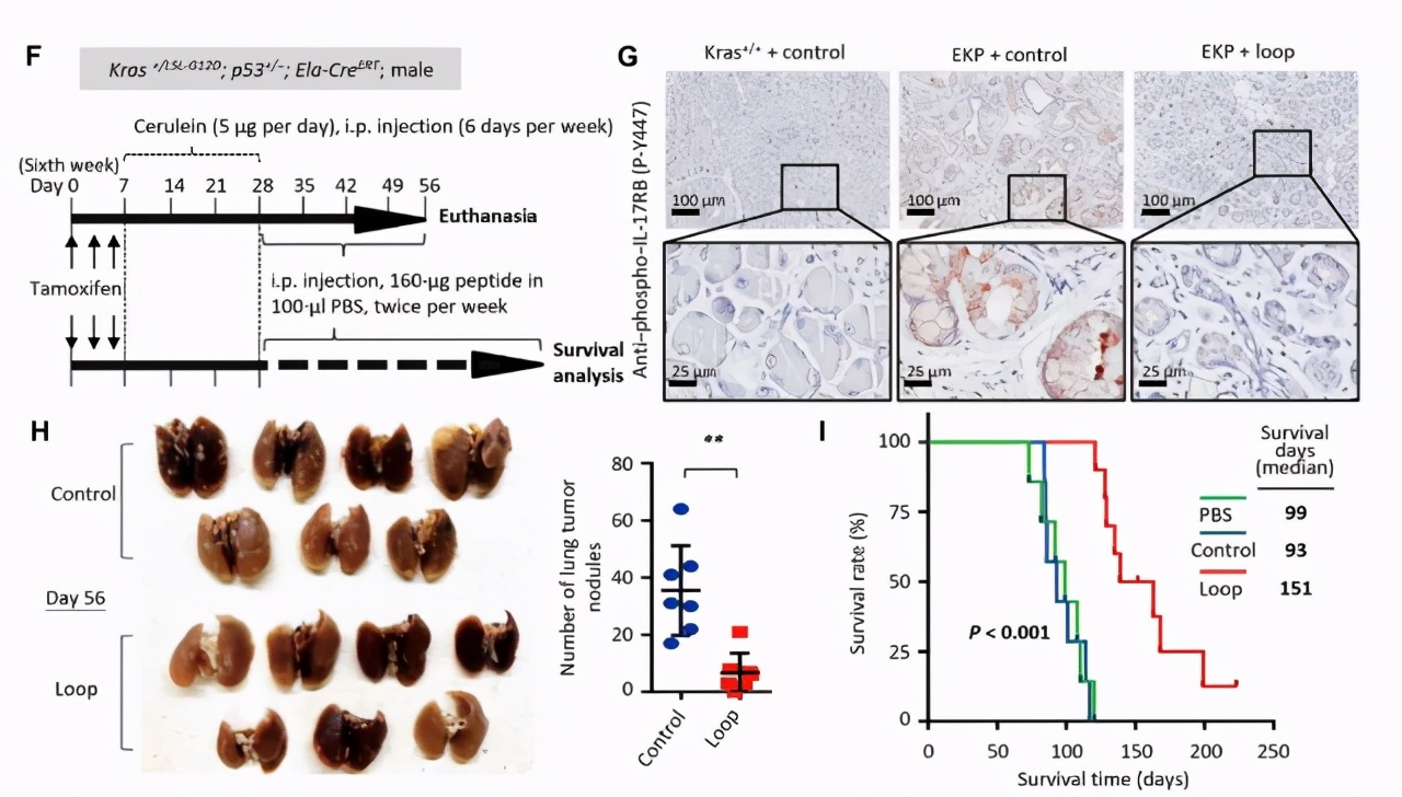 胰腺癌神经阻断术效果好吗,胰腺癌神经阻断术能持续多久有效