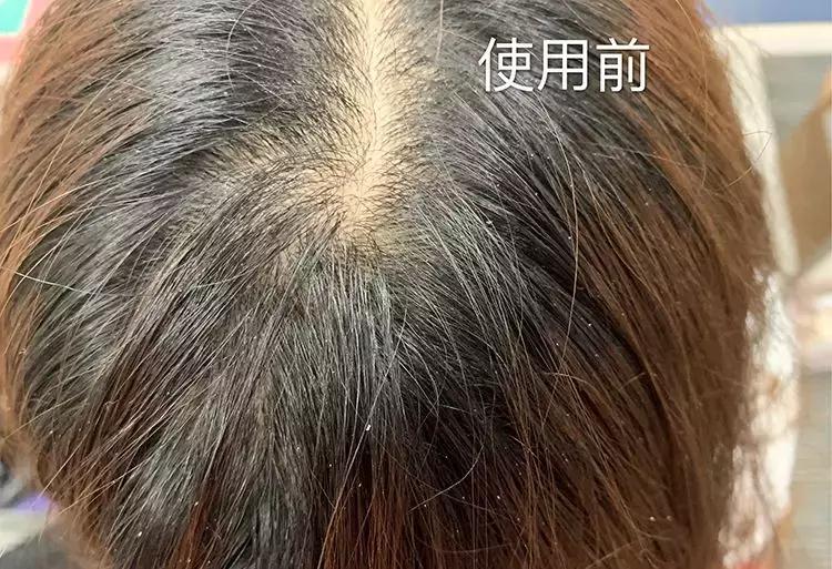 洗发水推荐控油蓬松樱花,claynal樱花洗发水推荐