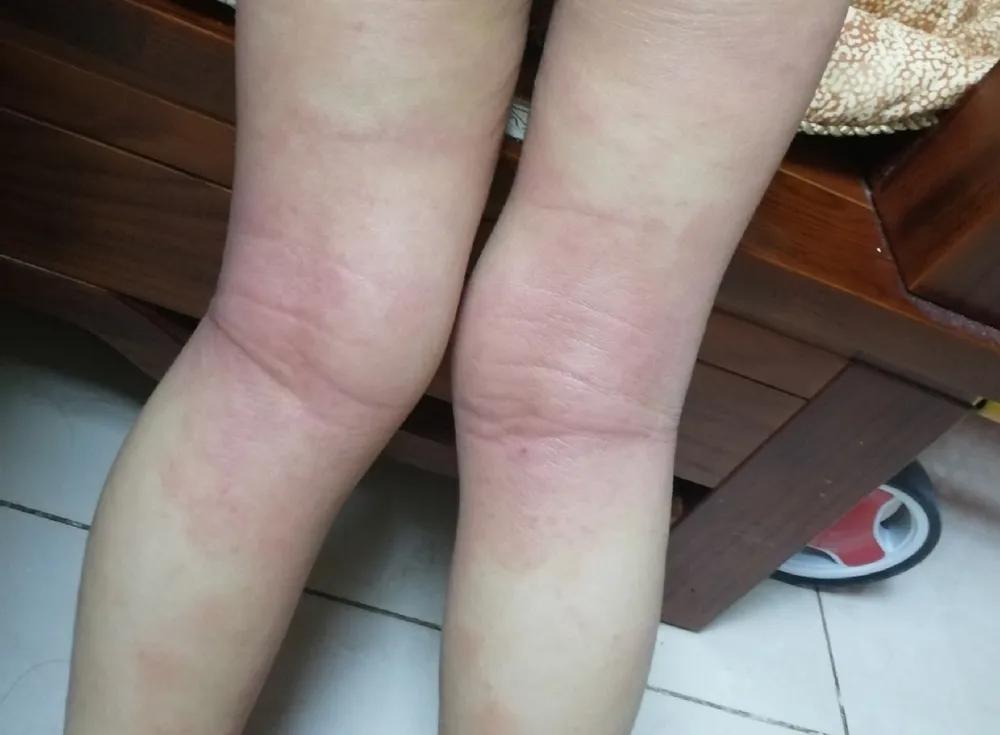 患者送锦旗真情暖人心,医护暖人心患者送锦旗致谢