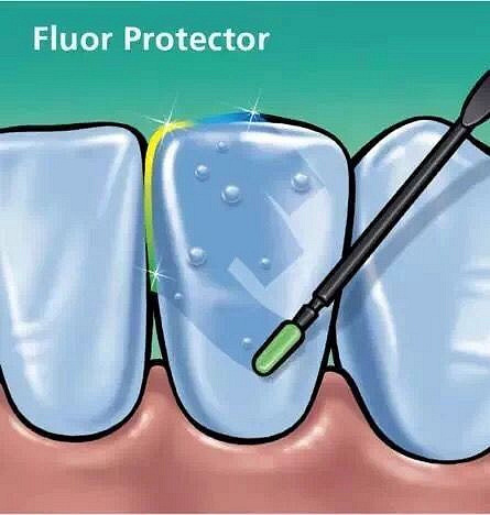 婴儿牙齿脱矿的原因有哪些,牙齿脱矿什么原因