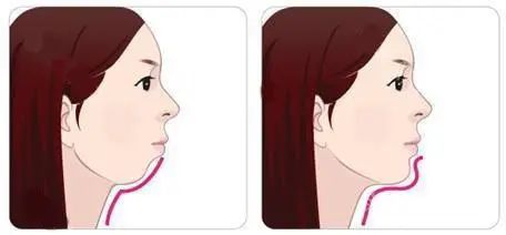 嘴凸的女生其实也很好看,凸嘴女生怎么微笑好看