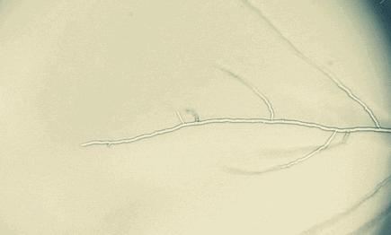 下体霉菌瘙痒快速止痒小妙招,外阴霉菌瘙痒怎么办