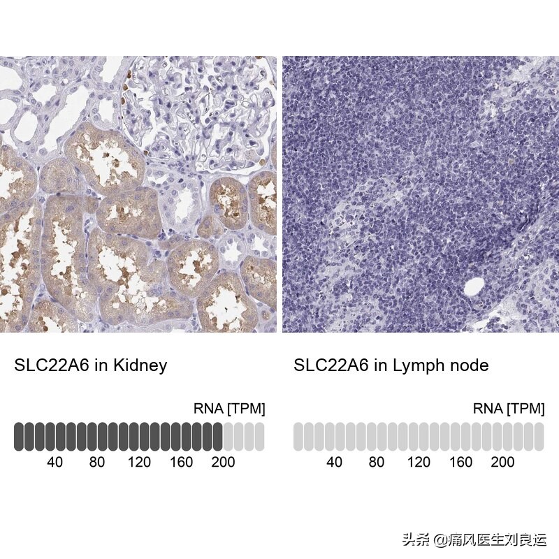 痛风是遗传因素大还是后天因素大,痛风是不是有遗传的因素呀