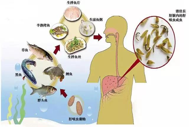 很多食物都有寄生虫,哪些寄生虫会造成生命危险