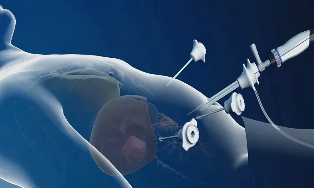 乙肝患者肝血管瘤会癌变吗,有乙肝肝内有血管瘤会癌变吗