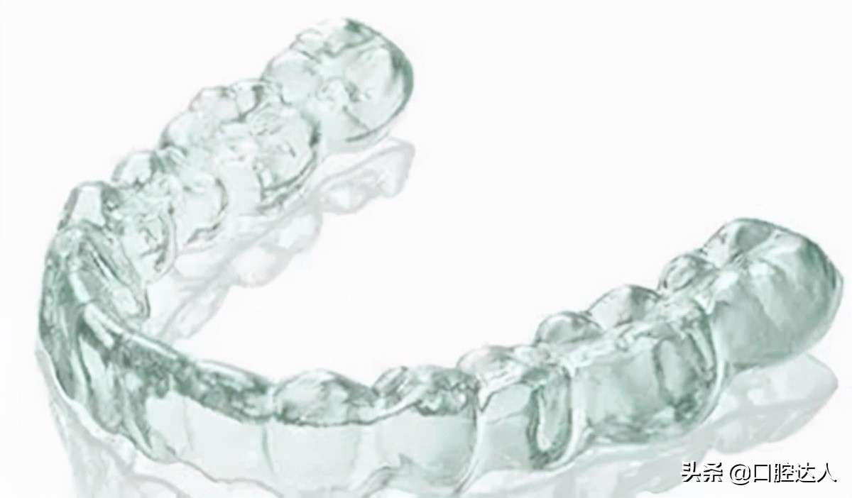 矫正牙后的保持器戴多久,矫牙结束后保持器需要戴多久