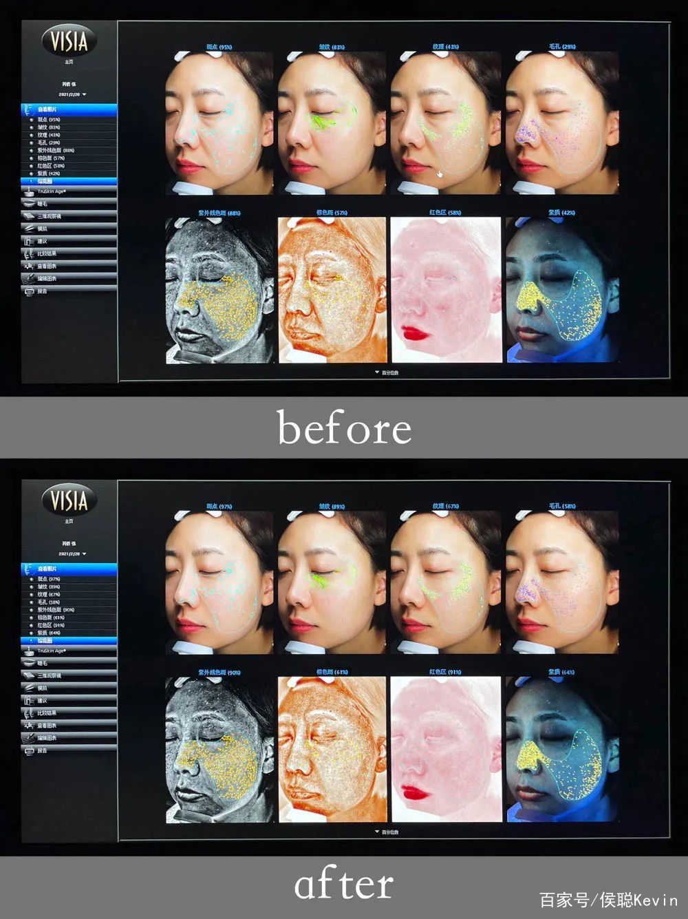 樱花皮肤补水保湿 (樱花美肌焕颜)