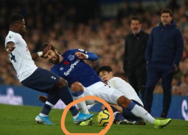 慎点铲球导致戈麦斯脚踝90度变形,戈麦斯断腿还能踢球吗