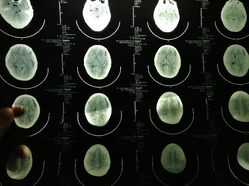 安医附二院生孩子经历,安医二附院生娃