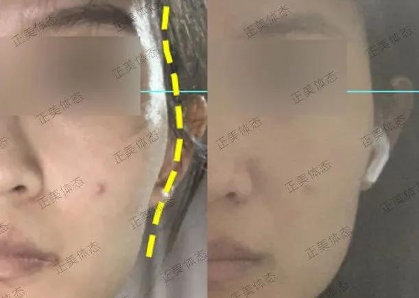 拯救颧骨高的教程,拯救脸大女生