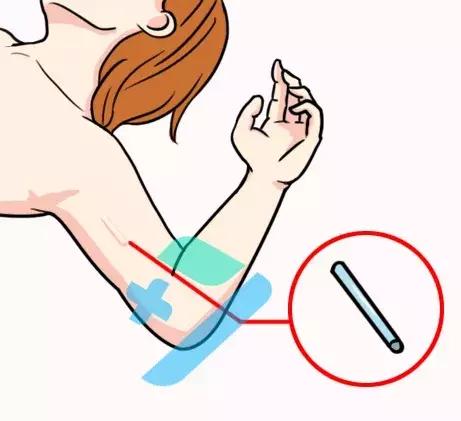 避孕率高达98%,避孕棒的准确率有多高