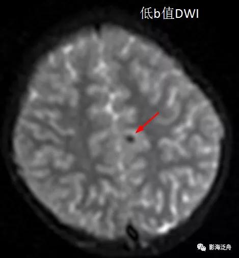 棰呰剳纾佸叡鎸痙wi搴忓垪,棰呰剳dwi搴忓垪鏈鏄庢樉寮傚父