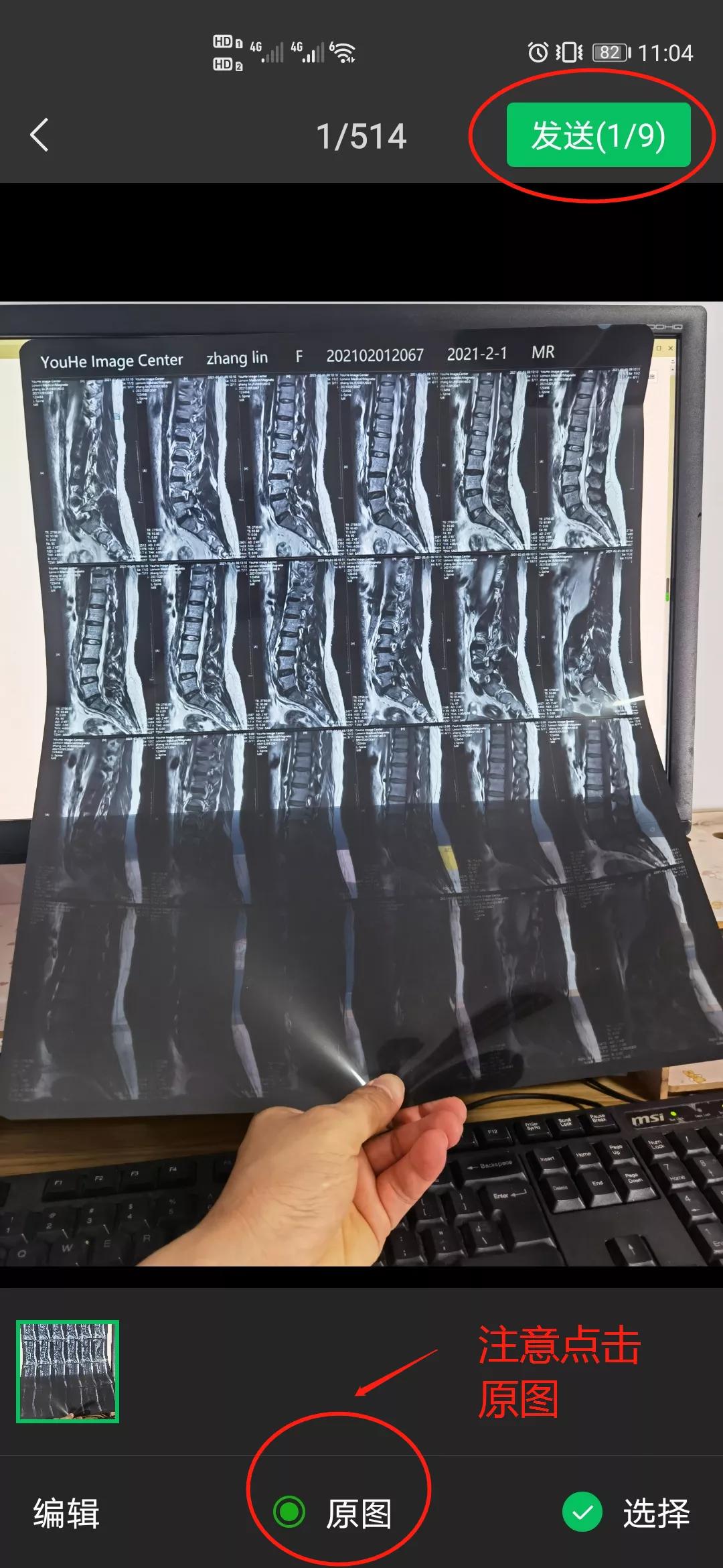 给医生拍照怎么拍,怎么给医生拍视频