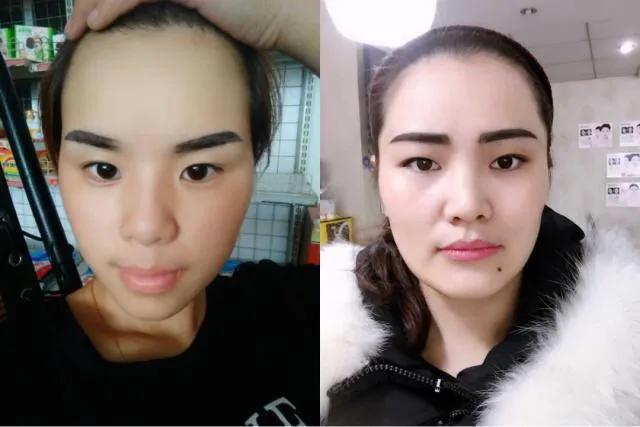 为什么医生不建议女生纹眉双眼皮,为什么纹眉师不建议做野生眉