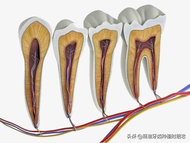 残牙根拔好还是不拔好,拔残牙根过程