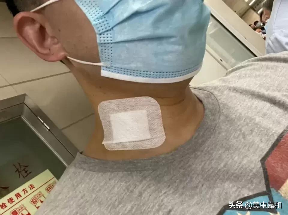 热死癌细胞疗法,烫死癌细胞到底靠不靠谱