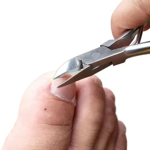 脚指甲注意事项,脚指甲上面的肉扎着疼