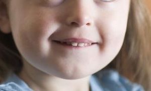 惊“牙”！每4个小朋友里就有3个牙列不齐