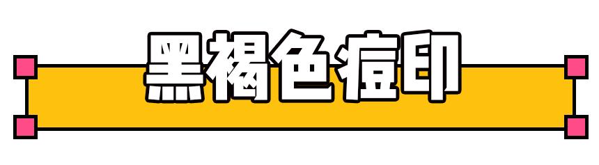 如何祛痘印？看了这篇能解决你大部分的问题！