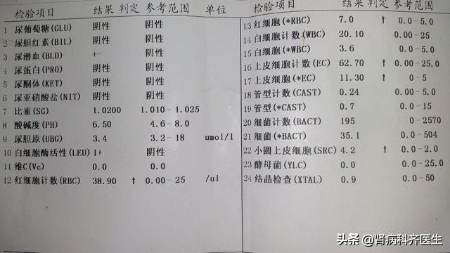 中医血尿与尿血的鉴别要点,尿潜血常见知识