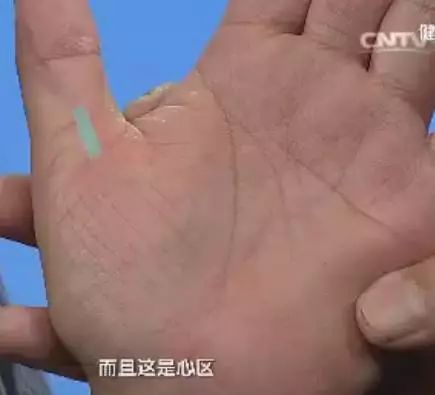 手诊10种常见病从手上就能看出来,手形看健康