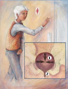 女士尿痛可能会是怎么回事？不一定都是感染