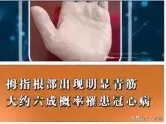 什么地方有青筋,这五个地方长痣要注意