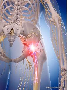 腰椎间盘突出压迫神经腿和屁股疼,腰椎间盘突出压迫神经屁股和腿麻