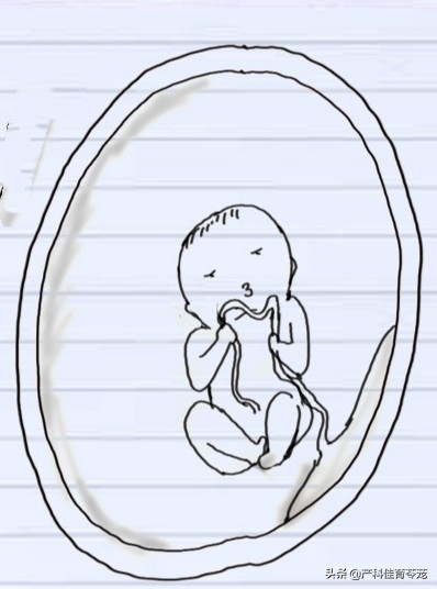 胎心监护脐带受压怎么解决,做胎心监护能看出来脐带问题吗