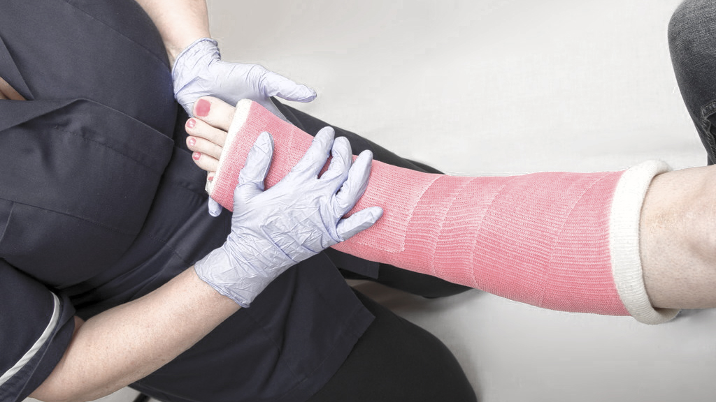 打石膏这个动作要多久,打石膏后多久能恢复运动