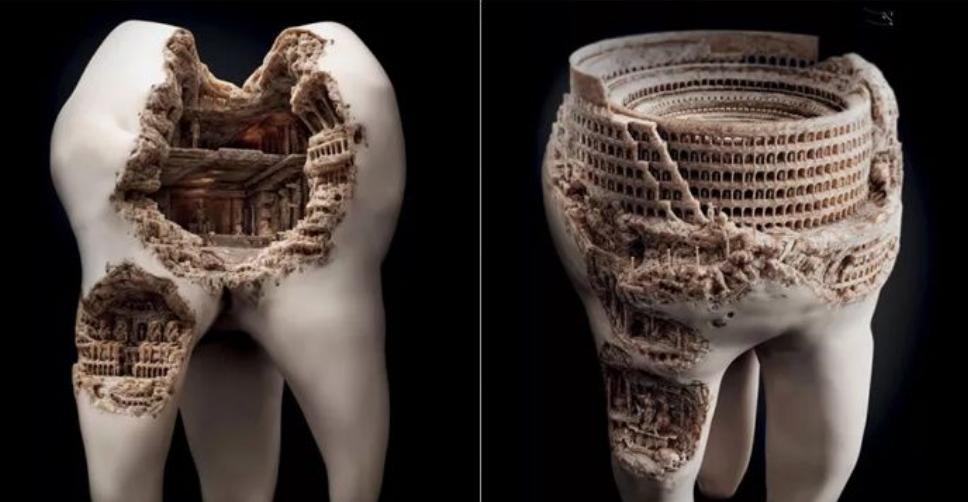 小孩牙齿蛀牙烂掉还会长出来吗,补过的牙齿还会蛀牙吗