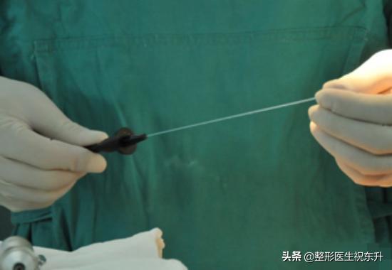 射频溶脂减肥手术具有三大并发症,做激光美容前需要注意什么