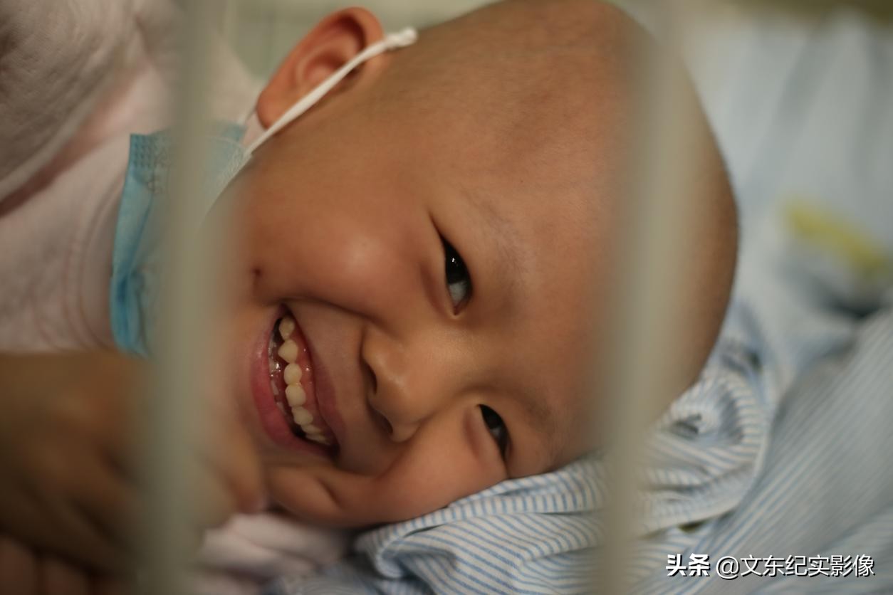 4岁小孩牙龈出血是什么原因,四岁孩子牙龈出血什么原因